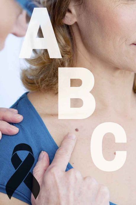 What are the ABCDE's of Skin Cancer