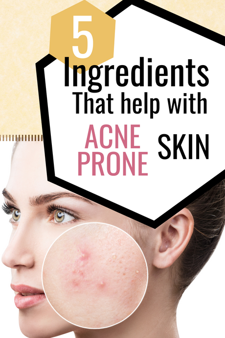 5 Ingredients That Help With Acne Prone Skin