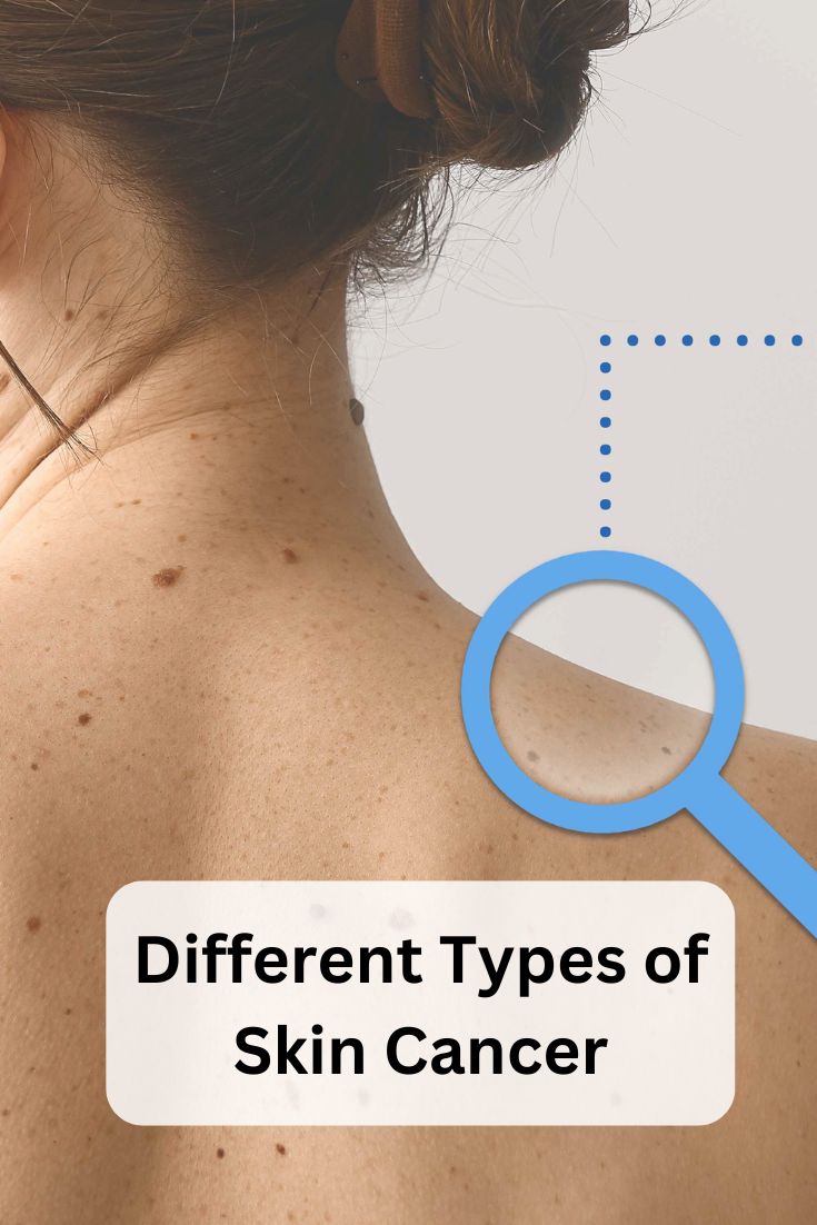 Skin Can Types What Are the Different Types of Skin Cancer – SunLux Skincare